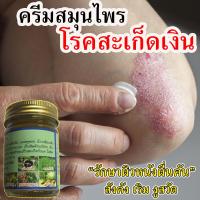 ราคา สุดยอด สมุนไพร 100 ครีมสมุนไพร ยาทาแก้โรคผิวหนัง แก้เชื้อรา ขี้เรื้อน สะเก็ดเงิน ลดอาการคันตามผิวหนัง กากเกลื้อน สกัดจากสมุนไพร ปลอดภัย100 (18884096873)