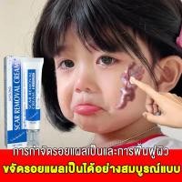 ราคา Breylee ของแท้ ลบรอยแผลเป็น ครีมทาแผลเป็น ครีมลดแผลเป็น scar removal cream ยาทาแผลคีลอยด์ ครีมทาแผลผ่าคลอด ลดแผลไฟไหม้ แผลน้ำร้อนลวก แผลผ่าตัดเป (20869650354)