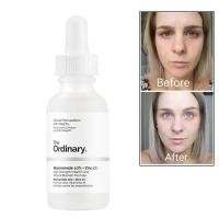 ราคา พร้อมส่ง The Ordinary Niacinamide 10 Zinc 1 30ml (9514416987)
