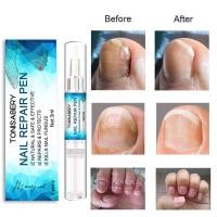 ราคา TO 07 ปากกา ขาว รักษาเชื้อราเล็บ ยาทาเชื้อราเล็บ เชื้อราที่เล็บ รักษาเล็บ เชื้อราที่เล็บ รักษาเล็บขบ ฆ่าเชื้อราที่เล็บ (20097164124)