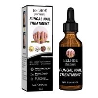 ราคา เซรั่มซ่อมแซมเล็บ EELHOE nail fungus medicine ยาแก้เชื้อราที่เล็บ ยากันเชื่อราเล็บ บำรุงเล็บเสีย น้ำมันบำรุงเล็บ ยาทาเชื้อราที่เล็บ ยาแก้เล็บขบ เชื้อราเล็บมือ ยาฆ่าเชื้อเล็บ ยาหยอดเล็บ ยาฆ่าเชื้อราเล็