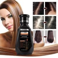 ราคา ป้องกันผมร่วง สารสกัดจากขิงสด สูตรน้ำขิง ปลูกผมอย่างอ่อนโยน บำรุงรากผม แชมพูขิงบริสุทธิ์ แชมพูช่วยลดการหลุดร่วงของเส้นผม (20491671515)