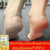ราคา EELHOE50ml เหมาะสำหรับส้นเท้าแตก ผิวแตก บำรุงผิว ดูแลมือ เท้าแตก มือแห้งกร้าน ผิวแตกแห้ง ครีมส้นเท้าแตก ครีมสันเท้าแตก ครีมทาเท้าขาว ครีมทาเท้า ครีมบำรุงเท้า ครีมทาส้นเท้า ครีมทาส้นแตก ดูแลเท้า ครีมทา