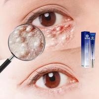 ราคา อายครีม ครีมลดถุงใต้ตา ครีมทาใต้ตาดำ ครีมแก้ขอบตาดำ ครีมลบรอยตีนกา ครีมบำรุงใต้ตา ยกกระชับเม็ดไขมัน แก้ขอบตาดำ ลดความหมองคล้ำ ขอบตา (15875944324)