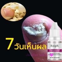 ราคา เซรั่มรักษาเล็บ เซรั่มบำรุงเล็บ น้ำมันบำรุงเล็บ เชื้อราที่เล็บ เล็บหลุดลอก ต่อต้านเชื้อราเล็บมือ น้ำยารักษาเล็บ เล็บพัง ยารักษาเล็บขบ เล็บเท้า น้ำยาบำรุงเล็บ เซรั่มทาเล็บ ดูแลเตียงเล็บ ให้สวย ดูแลเล็บ