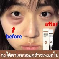 ราคา ครีมลดถุงใต้ตา ครีมรอบดวงตา อายครีมลดใต้ตา เซรั่มลดถุงใต้ตา ถุงใต้ตาหย่อน ริ้วรอยใต้ตาลดถุงใต้ตา เติมน้ำเพิ่มความชุ่มชื่น ริ้วรอยใต้ตาลดถุงใต้ตา (17365285958)