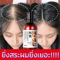 ราคา ของแท้ 100 แชมพูเร่งผมยาว ยาสระผมแก้ร่วง Hair loss shampoo ยับยั้งรังแค แชมพูลดผมร่วง แชมพูแก้ผมร่วง ผมบาง ปลูกผม เร่งผมเกิดใหม่ ผมยาวไว แชมพูสมุนไพร ยาสระผมแก้ผมร่วงสูตรแก้ปัญหาผมร่วง แชมพูขิงเพียว (