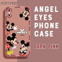 ราคา Hontinga เคสโทรศัพท์ iPhoneเคสมือถือสำหรับ iPhone X XS XR XS MAX ฝาหลังซิลิโคนนิ่มสี่เหลี่ยมลายการ์ตูนมิกกี้เมาส์เคสป้องกันกล้องกันกระแทกเคสยางเคสโทรศัพท์แบบนิ่มสำหรับเด็กผู้หญิง (14860161427)