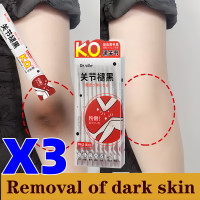 ราคา เตรียมจัดส่ง ครีมทาข้อศอกดำ ครีมทาขาหนีบดำ ครีมทาขาหนีบ 10g ครีมทาคอดำ ทากำจัดเมลานิน ไวท์เทนนิ่งที่ลับทาได้ทั้งตัว ครีมทาจักแร้ดำ ครีมขาหนีบดํา คอดำ ครีมทาขาหนีบ ครีมแก้คอดำ ครีมทาข้อศอกดำ ครีมทาแก้ 