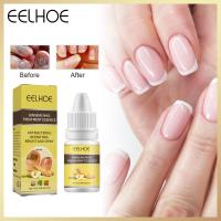 ราคา Eelhoe เอสเซนส์บำรุงผิวบำรุงเล็บและการรักษาเล็บเชื้อราดูแลเล็บเอสเซนส์บำรุงผิวเชื้อราที่เล็บการรักษาเชื้อราที่เท้าดูแลเล็บเท้าเอสเซนส์เล็บบำรุงเท้ากำจัดเชื้อราป้องกันการติดเชื้อ Paronychia Onychomycos