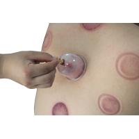 ราคา ถ้วยเปล่าทางการแพทย์สิบสองถ้วยปรากฏถ้วยเปล่าเพื่อสุขภาพ (20023773501)