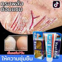 ราคา รุ่นใหม่2023มีผลทันที ครีมส้นเท้าแตก เหมาะสำหรับส้นเท้าแตก ผิวแตก บำรุงผิว ครีมสันเท้าแตก ครีมทาเท้าขาว ครีมทาเท้า ครีมบำรุงเท้า ครีมทาส้นเท้า ครีมทาส้นเท้าแตก ครีมทาส้นแตก ครีมเท้าขาว ครีมบำรุงส้นเท้