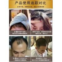 ราคา สมุนไพรโสม แซมพูสมุนไพรจีน แชมพูบำรุงหนังศรีษะ ปลูกเส้นผม ลดปัญหาผมร่วง ผมบาง ลดอาการคัน ขจัดรังแคผลิตจากสารสกัดจากธรรมชาติจากขิงแท้ (20716319908)