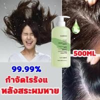 ราคา แชมพูขจัดรังแค DG 500ML ยาสระผมเชื้อรา แชมพูมะเดื่อ แชมพูแก้ผมร่วง แชมพูสมุนไพรยาสระผม ยาสระผมรังแค แชมพูแก้เชื้อรา แชมพูรักษารังแค ยาสระผมขจัดรังแค ยาสระผมแก้เชื้อรา แชมพูคัน (16984126294)