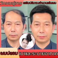 ราคา ผมปลอม เบาและระบายอากาศ เสริมปริมาณจำนวนเส้นผม วิกผมชาย ผมจริงวิกผมสั้น ชายวิกผมผู้ชายวิกผม ผมปลอมผู้ชาย วิกผมผู้ชาย วิกผมชายสั้น วิกผมจริงผมแท้ วิกผมผู้ชายแท้ วิกผมสำหรับผู้ชาย วิกผมสั้นของผู้ชาย วิก