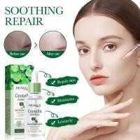 ราคา BIOAQUA Centella Asiatica บำรุงใบหน้าน้ำมันเซรั่มควบคุมใบหน้าสาระสำคัญของให้ความชุ่มชื้นเติมน้ำ Anti Ac Ne 30มล (20850237518)