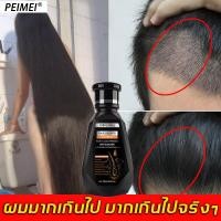 ราคา แก้ปัญหาเส้นผม PEIMEI แชมพูแก้ผมร่วง แชมพูขิง ยาสระผมแก้ร่วง 250ml ซ่อมแซมผมเสีย แชมพูปลูกผม แชมพูสระผม แชมพูขิงเพียว แชมพูผมดก (12897979559)