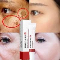 ราคา Facial Skin Care Anti freckle Cream amp Anti Acne Cream Remove Dark Spots Brighten Skin Anti Aging Skin Lightening Skin Care (16842807101)
