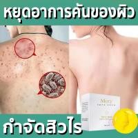 ราคา สบู่กำจัดไร สบู่หน้าขาวใส สบู่ลดสิวหน้า สบู่น้ำผึ้งทอง สบู่หน้าเงาแท้ คลีนซิ่งลดสิว สบู่กำจัดไรสิว สบู่กำจัดสิว ไวท์เทนนิ่ง สบู100g (17508801973)