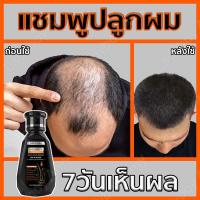 ราคา ขายร้อน แชมพูสมุนไพรขิงบำรุงผม แชมพูแก้ผมร่วง แชมพูปลูกผม ขิงช่วยป้องกันผมร่วง เร่งผมเกิดใหม่ ผมยาวไว ป้องกันผมล่วง เร่งผมยาว แชมพูเร่งผมยาว แชมพูลดผมร่วง แชมพูสำหรับลดผมขาดหลุดร่วง แชมพูขิงเพียว ยาส 