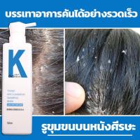 ราคา ผม ป้องกันรังแค ควบคุมความมัน ครีมหมักผม แชมพูแก้ผมร่วง OUSHLIAN บำรุงหนังศีรษะ ครีมนวดผม ลดอาการคัน แชมพูขจัดรังแค แชมพู (16247831700)