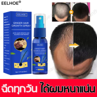 ราคา ปริมาณของเส้นผมเพิ่มมากขึ้น EELHOE สเปรย์ปลูกผม เร่งผมขึ้นใหม่ เร่งผมยาวไว ป้องกันผมร่วง Hair Growth ปลูกผม เร่งผมเกิดใหม่ แก้ปัญหาผมร่วง ลดผมร่วง น้ำยาใส่ผม น้ำยาปลูกผม น้ำยาเร่งผมยาว ปลูกผมเร่งด่วน