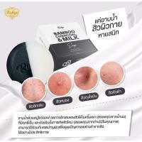 ราคา ส่งฟรี Rabye สบู่โชว์ออฟ ลดสิวผิวกาย ลดการอักเสบ ยับยั้งแบคทีเรีย ลดการเกิดสิวใหม่ ผิวขาวใส show off soap (20047069656)