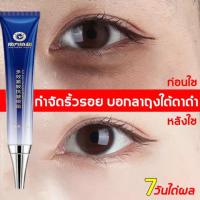 ราคา ครีมถุงใต้ตา ครีมลดถุงใต้ตา ครีมลบรอยตีนกา คลีมลดถุงใต้ตา บำรุงรอบดวงตา แก้ใต้ตาคล้ำ ครีมบำรุงรอบดวงตา อายครีม ครีมทาใต้ตา ครีมทารอบดวงตา ครีมทาใต้ตาดำ อายครีมบำรุงตา ขอบตาดำ รอยตีนกา ครีมแก้ขอบตาดำ e