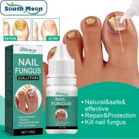 ราคา South Moon Nail Essence Feet Care Serum Nails Fungus Foot Toe Fungal Removal Gel Paronychia Onychomycosis Repair Fungal Nail Repair Essence Nail Toe Nail Anti Fungus Removal Nail Gel 10Ml (16629379883