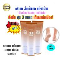 ราคา ครีมทาเท้าแตก ครีมทาเท้า ครีมทาส้นเท้่าแตก หัวเข่าด้าน ตาตุ่มดำ ข้อศอกด้าน สกินซอฟเทนเนอร์ Skin Softener ชุด 2 หลอด 218 บ ส่งไว (9707575528)