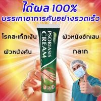 ราคา ยาทาแก้คัน แก้คัน ตุ่มเหงื่อ ผื่นผิวหนัง อับชื้น ผด ครีมทาภายนอก 20g (21045737374)