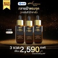 ราคา Yanhee anti melasma serum 1 ขวด ยันฮี แอนตี้ เมลาสม่า เซรั่ม ฝ้า กระ จากยันฮี (20872097395)
