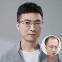 ราคา วิกผมผู้ชายผมสั้นจริง ๆ นะครับหัวล้าน และหัวล้าน (17596425519)