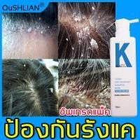ราคา ลดอาการคัน OUSHLIAN ผม บำรุงหนังศีรษะ ครีมนวดผม แชมพูแก้ผมร่วง ป้องกันรังแค ควบคุมความมัน แชมพูขจัดรังแค แชมพู ครีมหมักผม (16237192810)