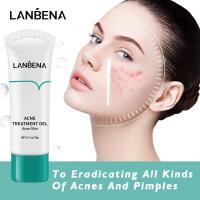ราคา LANBENA Acne Treatment Gel Remove Acne Cleaning Cream Acne Spots Face Acne Scars Skin Care Repair Comedone Pimple 20g (3706686214)