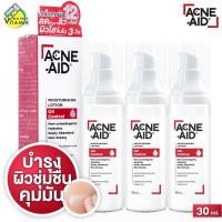 ราคา 3 ขวด Acne Aid Moisturising Lotion Oil Control แอคเน่ เอด มอยซ์เจอร์ไรซิ่ง โลชั่น ออยล์ คอนโทรล 30 ml (18850713752)