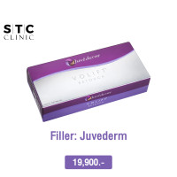 ราคา E voucher ฟิลเลอร์ Juvederm 1 cc (18892457706)