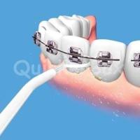 ราคา ซอกฟันสะอาด ขจัดเศษอาหาร เครื่องพ่นน้ำ Power Floss ซอกฟันให้สะอาดหมดจด (783764100)