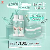 ราคา Shining โทนเนอร์ ก้น ขาหนีบ ข้อศอกหัวเข่า ให้ขาวเนียน ครีมทารักแร้ชายนิ่ง ครีมทารักแร้ขาว (12421882491)