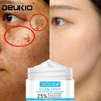 ราคา Whitening Freckle Cream Remove Melasma Acne Spot Pigment Melanin Care Spots Dark Skin Pigmentation Moisturizing Gel (11321832130)