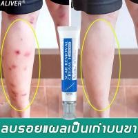 ราคา ครีมทาแผลเป็น ลบรอยแผลเปน ลดรอยเเผลเป็น น้ำร้อนลวก แผลผ่าตัด แผลเป็นจากยุงกัด ครีมลบรอยแผลดำ ครีมทารอยแผลเป็น ครีมลดรอยแผลเป็น 30G (21230431979)