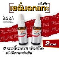 ราคา รีเบิร์ท เซรั่มรกแกะสูตรเข้มข้น REBIRTH PLACENTA EXTRACT CONCENTRATE SERUM 25ML เซรั่มบำรุงผิวซึมไว ลึกถึงผิวชั้นใน (17177874859)