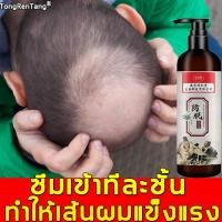 ราคา TongRenTang แชมพูแก้ผมร่วง 520ml บำรุงและเร่งการเจริญเติบโตของเส้นผม ป้องกันผมร่วง จาระบีบาลานซ์ ทำความสะอาดหนังศีรษะ ยาสระผมเชื้อรา ยาสระผมแก้ผมร่วง แชมพูสมุนไพร แชมพูบำรุง แชมพู (9377052521)