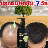 ราคา แชมพูขิงเพียว ZHENXIU 300ml แชมพู แชมพูแก้ผมร่วง ผมร่วงผมบาง แชมพูปลูกผมดก แชมพูลดผมร่วง แชมพูเร่งผมยาว shampoo (16541806595)