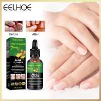 ราคา Eelhoe 7 Days Foot Anti Fungal Essence To Remove Onychomycosis Repair Liquid Repair Nail Fungus Essence Foot Care Serum Toe Nails Fungal Removal Nail Care 50ml (16441230704)