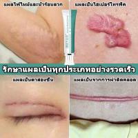 ราคา breylee ของแท้ ครีมลดแผลเป็น ครีมลบแผลเป็น scar removal cream ยาทาแผลคีลอยด์ ครีมทาแผลผ่าคลอด ลบลอยแผลเป็น ลดแผลไฟไหม้ แผลน้ำร้อนลวก ครีมทาแผลผ่าตัด (19526536750)