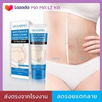 ราคา ลดลอยแตกลายจากการท้อง ใช้สำหรับคุณท้องโดยเฉพาะ ครีมลดรอยแตกลายสำหรับคุณแม่ตั้งรรภ์ ป้อนกันรอยแตกลายขนาดตั้งครรภ์ ครีมแก้รอยแตกลายหลังการคลอดและรอยแตกลายที่ต้นขาต้นแขนของนักเรียน (13709684144)