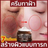ราคา ครีม แก้ ฝ้า กระ ครีมทาฝ้าหนาๆ ครีมแก้ฝ้าแท้ๆ ครีมทาฝ้าอาร์บูติน ครีมลดฝ้ากระ ครีมหน้าขาวใส ครีมทาหน้าฝ้า ครีมลดฝ้า มอยซ์เจอไรเซอร์ ไวท์เทนนิ่ง ฝ้า ต่อต้านริ้วรอย (16322645267)
