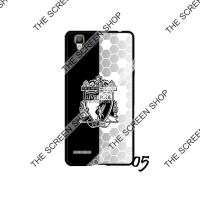 ราคา เคสโทรศัพท์ เคสมือถือ เคสสกรีน เคสliverpool เคสลิเวอร์พูล เคสหงษ์แดง OPPO F1 A35 รวมลาย หงษ์แดง (10099360845)