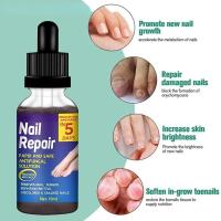 ราคา CW New Powerful Fungicidal Nail Fungus Repair Damaged Skin Essential Oils Essence Anti fungal Fungal Care Massage Oil (16869575134)